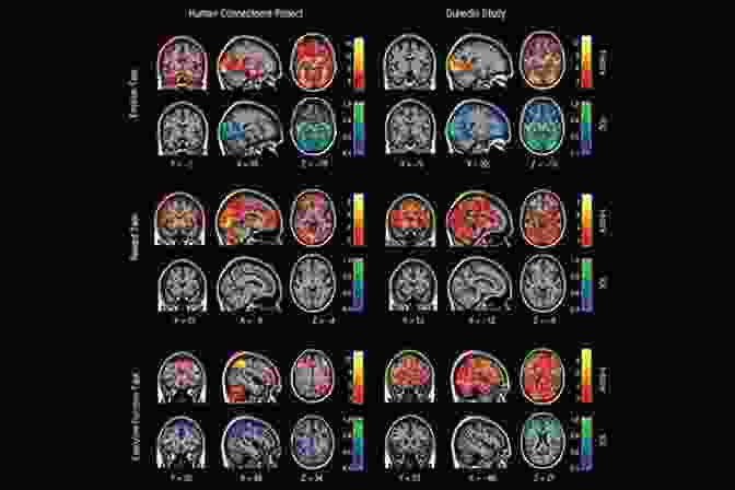 A Colored Brain Scan Showing Different Regions And Activity Patterns. The Little Of Neuroscience Haiku